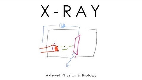 X-ray Scanning - A-level Physics