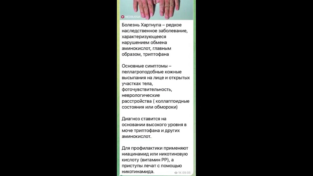 Human body: Болезнь Хартнупа/08.09.22 - YouTube