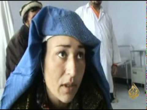 ضعف التنمية في أفغانستان