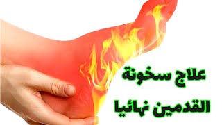 علاج سخونة القدمين نهائيا