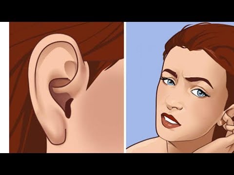 Video: Che cos'è l'elenco delle entità dell'orecchio?