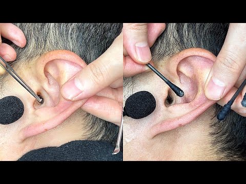 Best ear cleaning ASMR #6