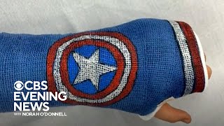Children's doctor uses cast art to bring smiles to patients