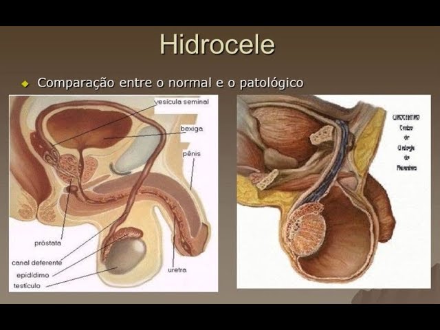 Que quando testículos seus incham o significa
