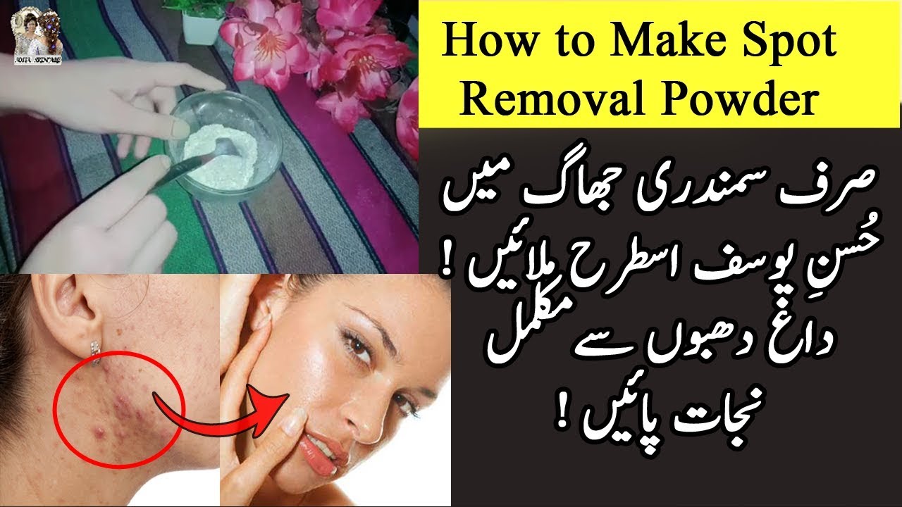 How to Make Dark Spot Removal Powder at Home - Home Remedy For Drak ...