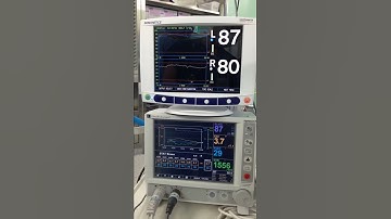 INVOS and Vigilance II