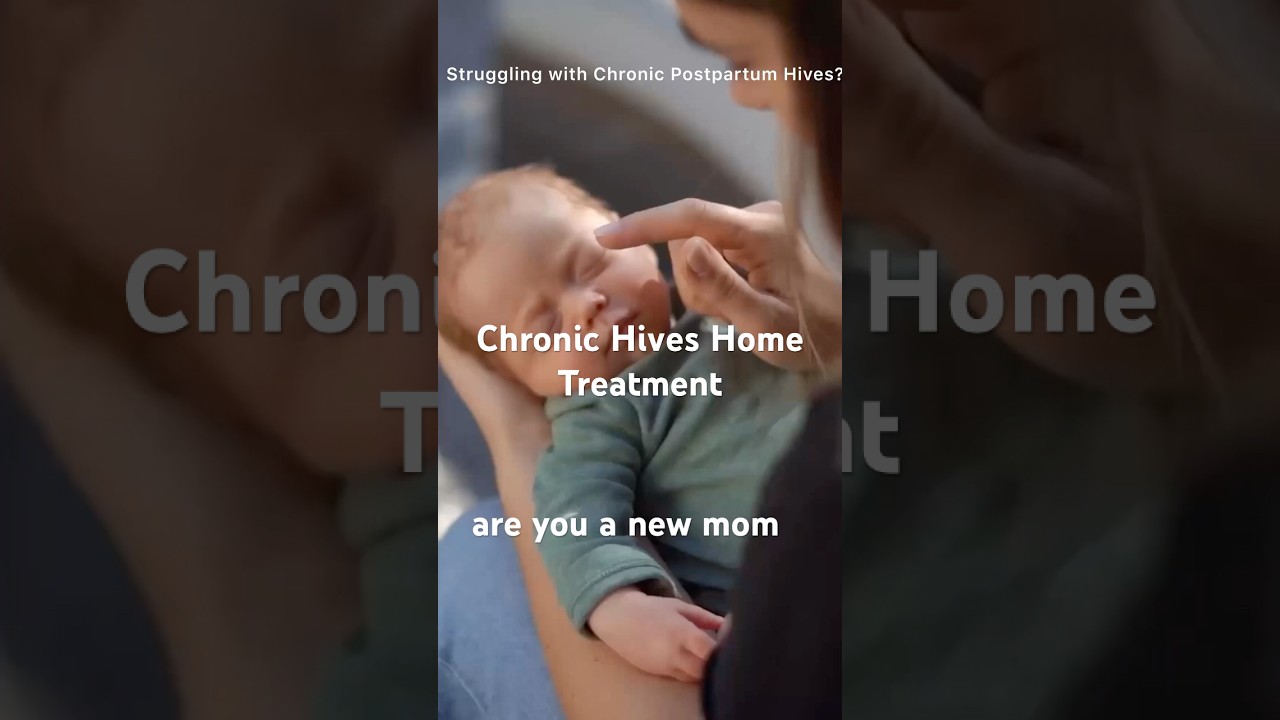 How to Treat Postpartum Hives: Effective Remedies That Work Fast
