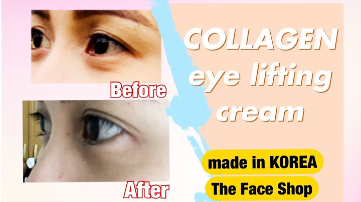 3w collagen lifting eye cream review năm 2024