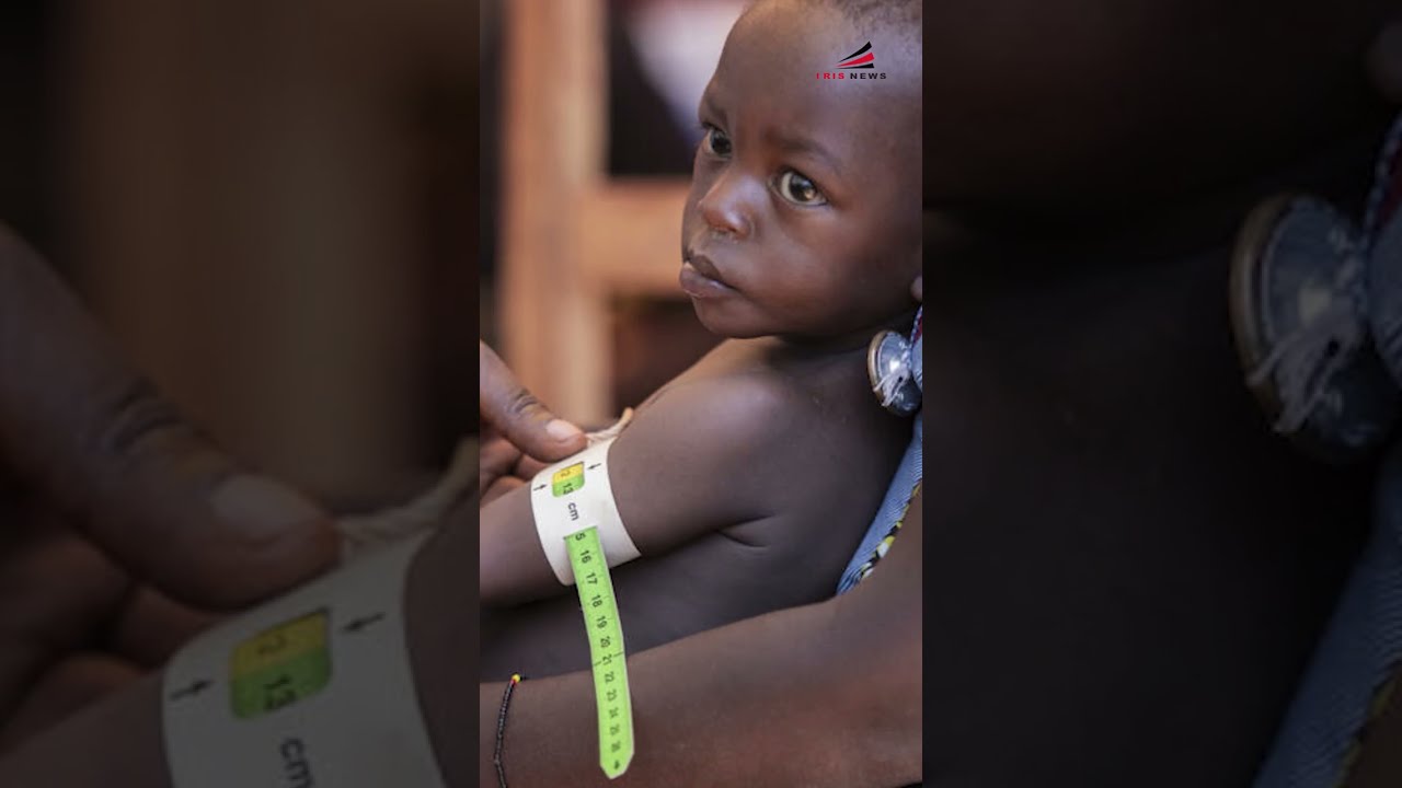 AVC uko ifata, ico ivako N'uko twoyirinda kurikirana Dr. Benjamin NDIHOKUBWAYO . #AVC #Stroke