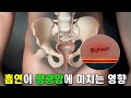 방광암, 바로 &#39;이것&#39; 때문에 생긴다! | 흡연 | 방광암 | 명의 | #EBS건강