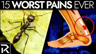 7 Of The Worst Pains Humans Can Feel by TheRichest 5,912 views 3 weeks ago 2 minutes, 16 seconds