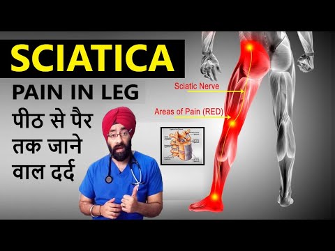 Understand Sciatica : पीठ से पैर तक दर्द  | Pain from Back to Legs | Dr.Education Hindi Eng