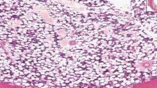 Shotgun Histology Bone Marrow