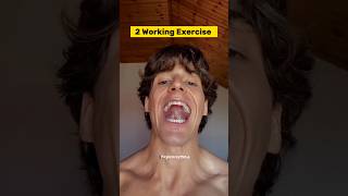 Correct way of Mewing | Mewing exercise | 90 days challenge | Day 14/90