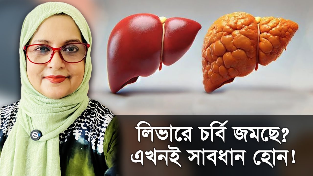 Жировая дистрофия печени: накапливается ли жир в печени? Будьте осторожны! | С доктором Шахназ Чо...