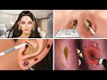 Asmr ear nose piercing treatment removes animation relax     