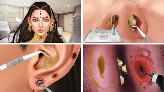 ASMR Ear, nose piercing treatment removes animation relax | 현실적인 케어 트리트먼트 애니메이션