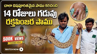 రక్త పింజర పాము కరిచింది Indian Russell's viper Snake bite venomous rescue lo Gonegandla{9966333589}