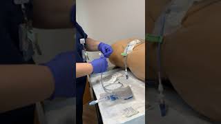 Externalize the Biliary Drain