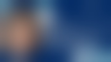 S-Core® Implant Delivery System - Dr. Journot, DPM - Medial Shoulder Talar Dome OC Lesion