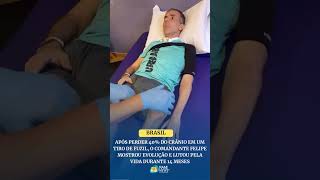 Após perder 40% do crânio em um tiro de fuzil, comandante Felipe mostrou evolução e lutou pela vida