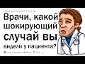 Врачи, какой самый шокирующий случай “о, я думал, что это нормально” вы видели у пациента?