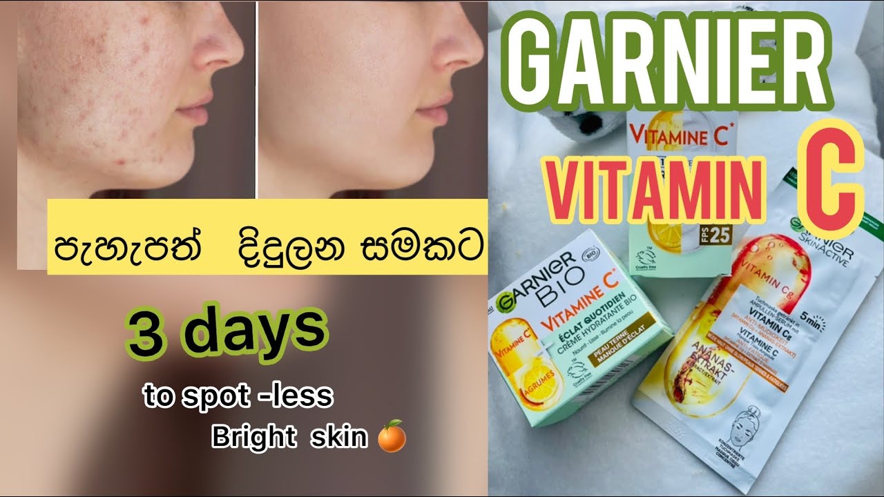 කුරුලෑ , පිග්මන්ටේශන් ,සමේ රැලි , අවපැහැය වැනි ගැටලු රැසකට විසදුම / garnier V.c skin glow products