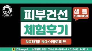 건선,아토피,한포진 재발없이 치료하는 방법 알려드릴께요