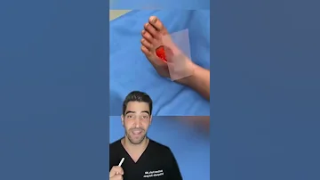 Skin Graft 