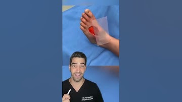 Thumbnail of Skin Graft