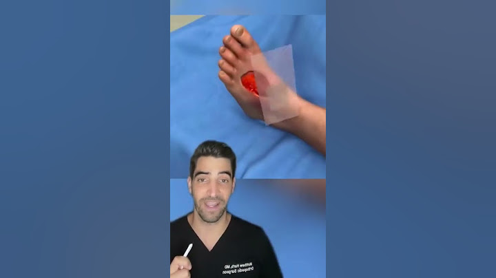 Skin Graft