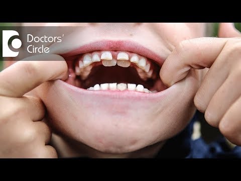 वीडियो: दांते की चोटी में क्या होता है?