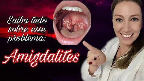 Porque algumas pessoas tem amigdalite bacteriana de repetição?