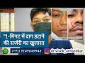"1-मिनट में दाग हटाने की सर्जरी का खुलासा | Permanent Scar Removal Surgery – Before & After Results