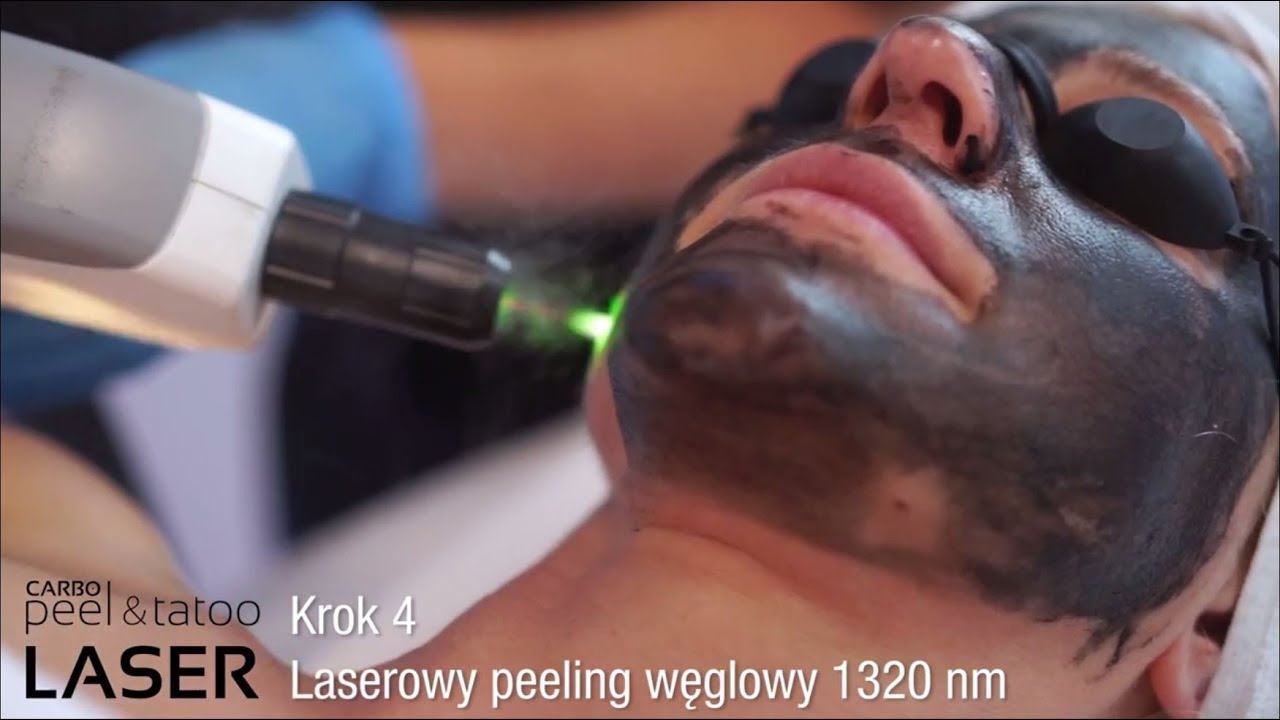 Laserowy peeling węglowy Black Doll - YASUMI Carbon Peel
