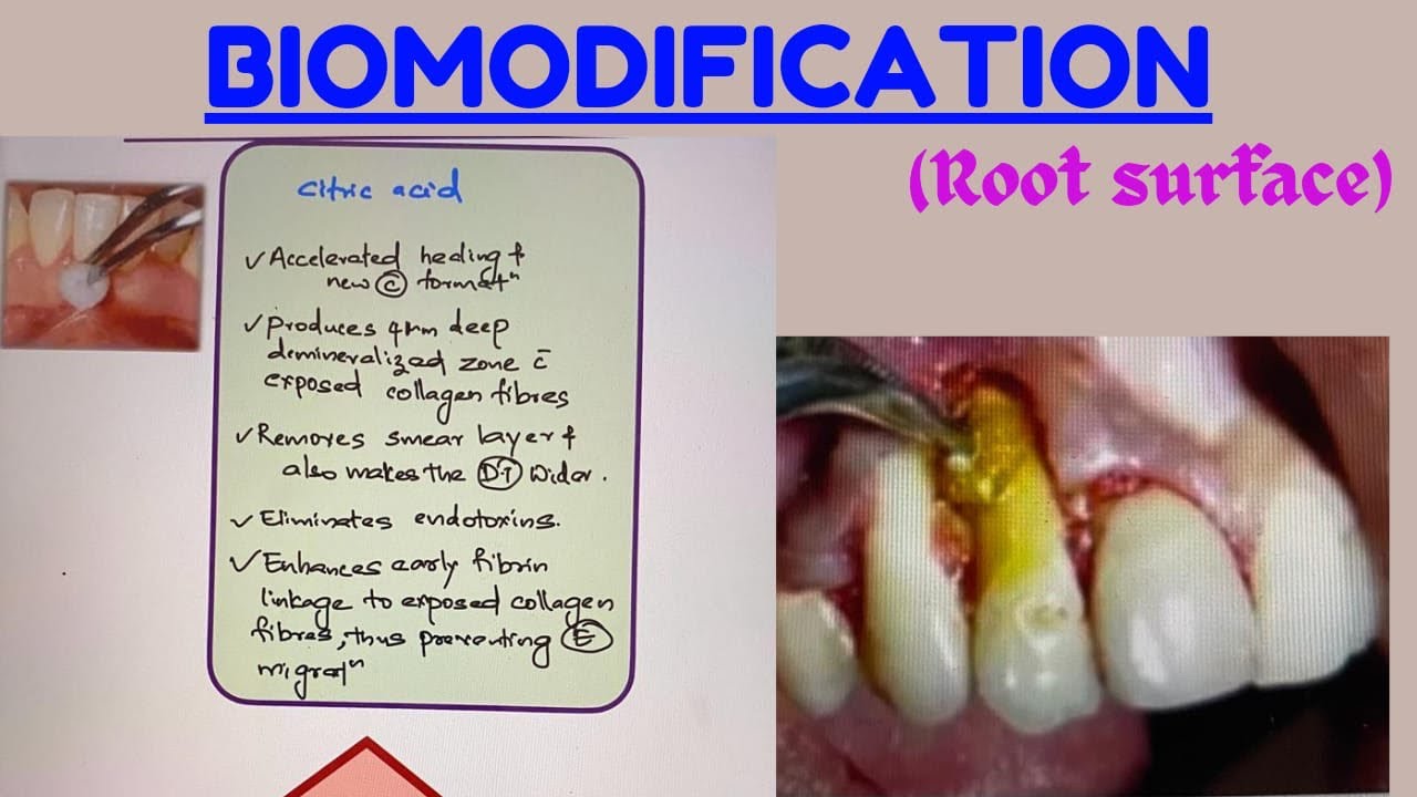 Learn biomodification within 5 mins..
