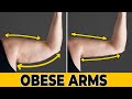 LOSE FLABBY OBESE ARMS FAT | SUPER EASY FOR BEGINNERS &amp; OBESE