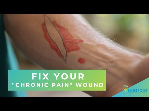 How to Fix