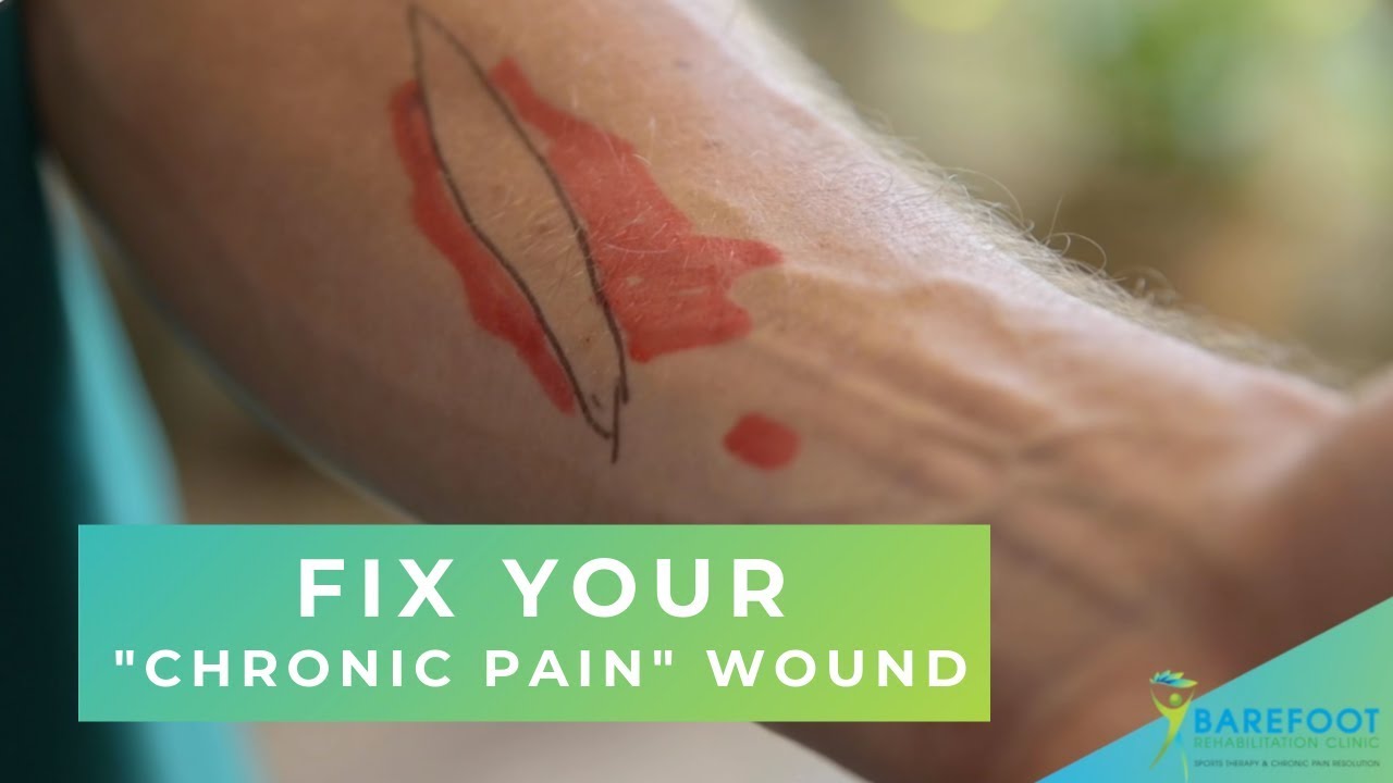 How to Fix a 