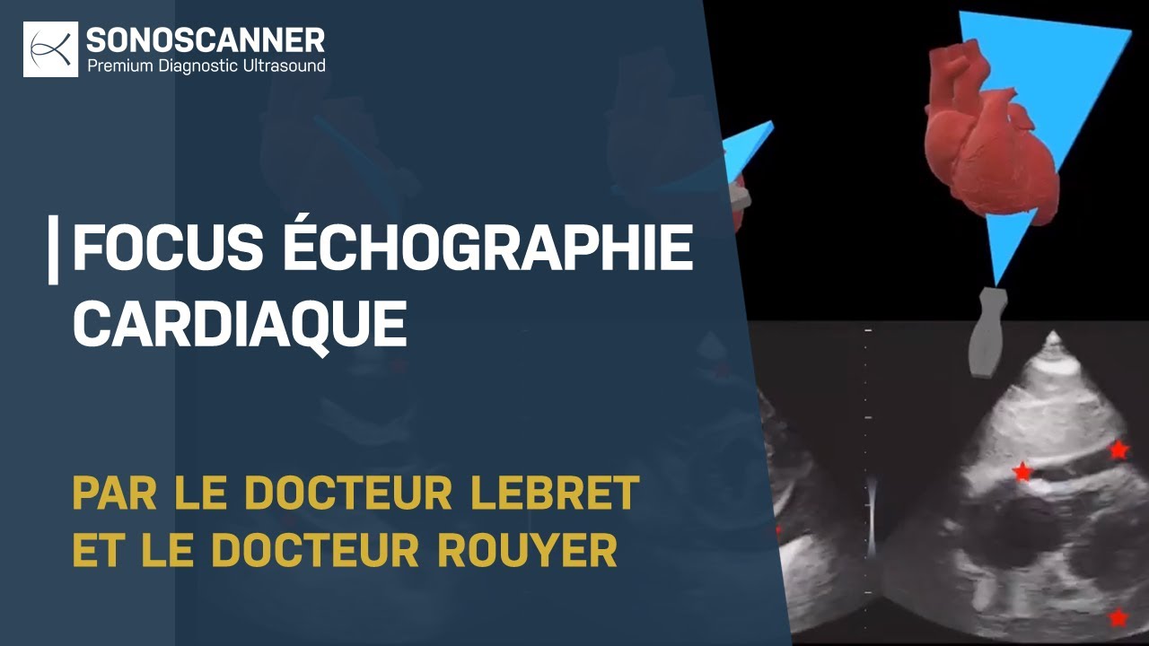 Replay Focus Echographie Cardiaque Sonoscanner