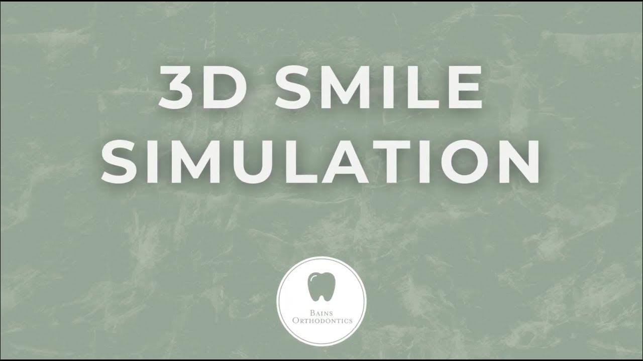 3D Smile Simulation! Braces & Invisalign Orthodontist Okemos, MI