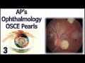 AP&#39;s Ophthalmology OSCE Pearls 3