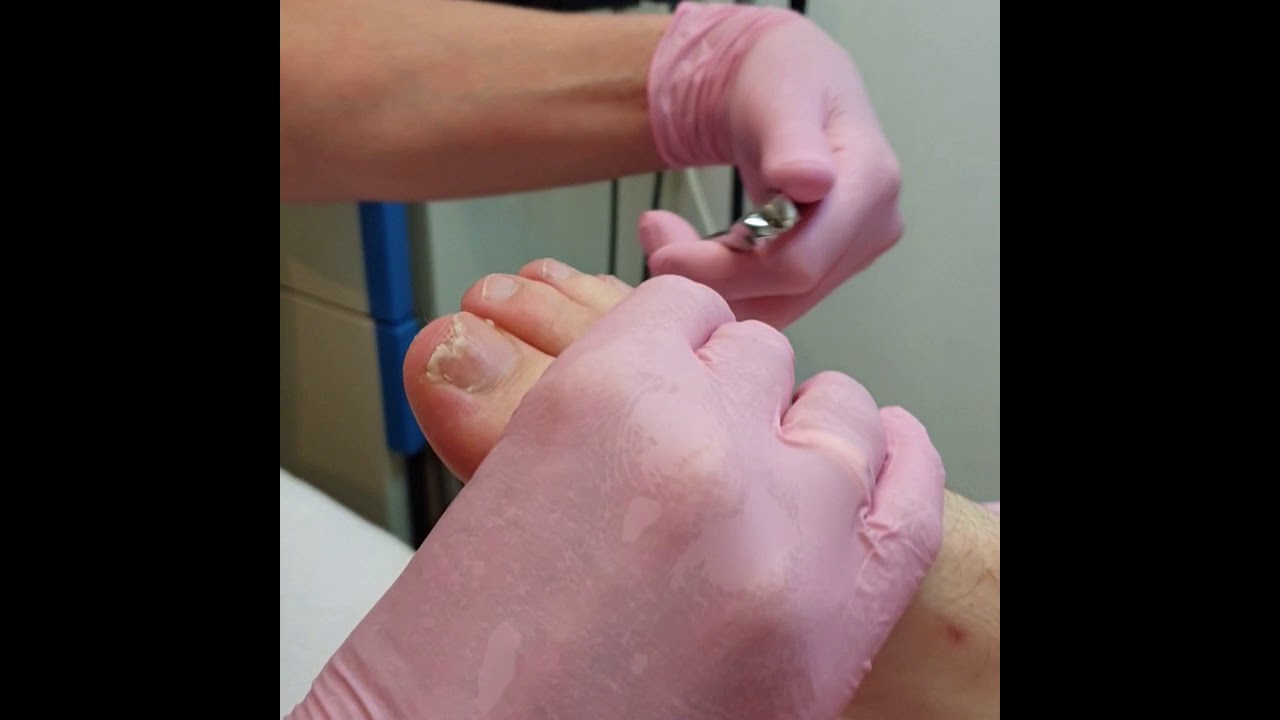 Nagels knippen instructie video online