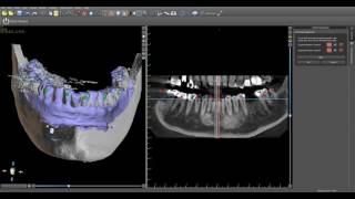 Review of Merge Functionality using "Matching Teeth" Technique