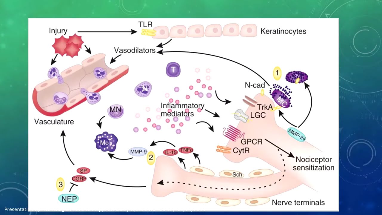 Corneal Neuropathic Pain