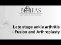 Late stage ankle arthritis  fusion  arthroplasty  bofas lectures of distinction
