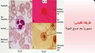 التحري عن جسيم بار  Barr Body Analysis