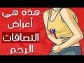 أعراض وجود التصاقات في الرحم ما هي الأسباب و هل تؤثر على الإنجاب أعراض وجود التصاقات في الرحم ما هي الأسباب و هل تؤثر على الإنجاب