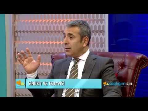Sinüzit belirtileri ve