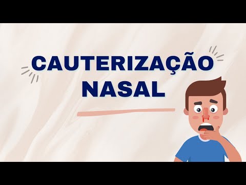 Vídeo: Quando o nariz deve ser cauterizado?